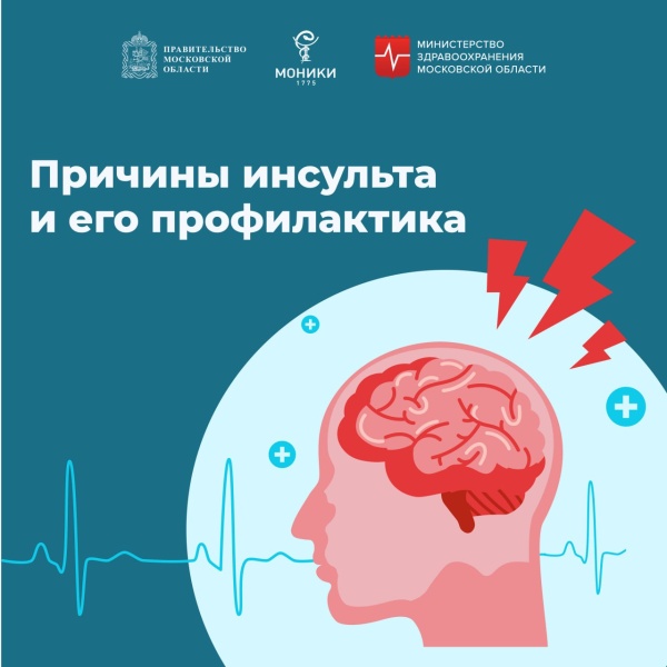 Как распознать инсульт и спасти жизнь близкого человека?